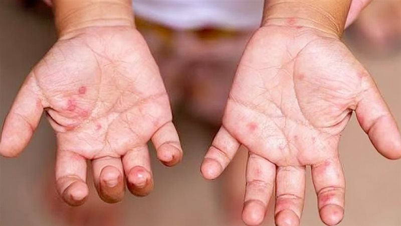 موقع الصفحة الأولى